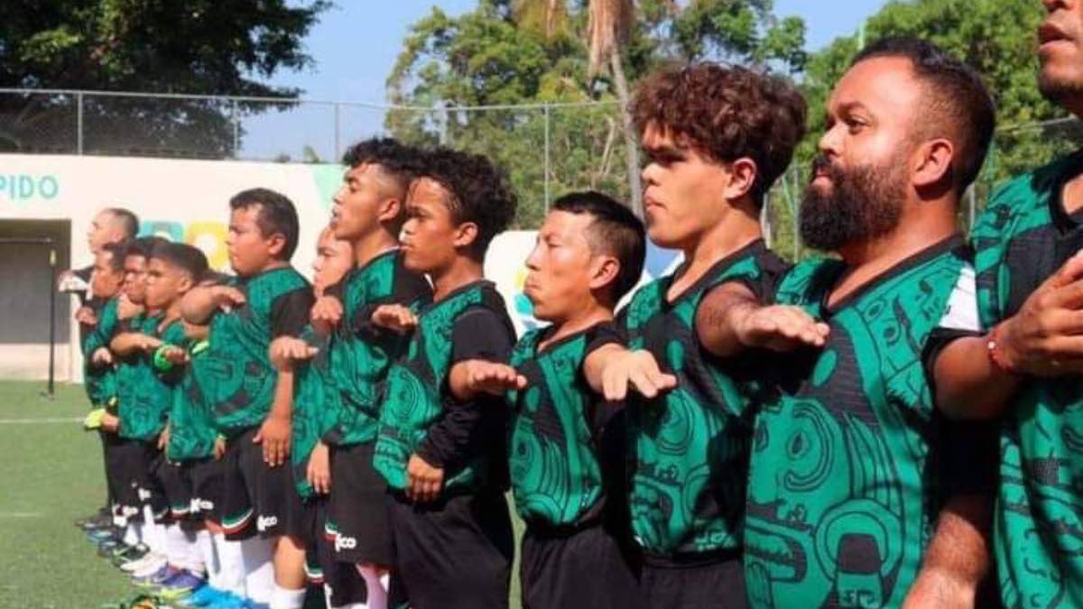 Selección Mexicana de Fúbol de Talla Baja
