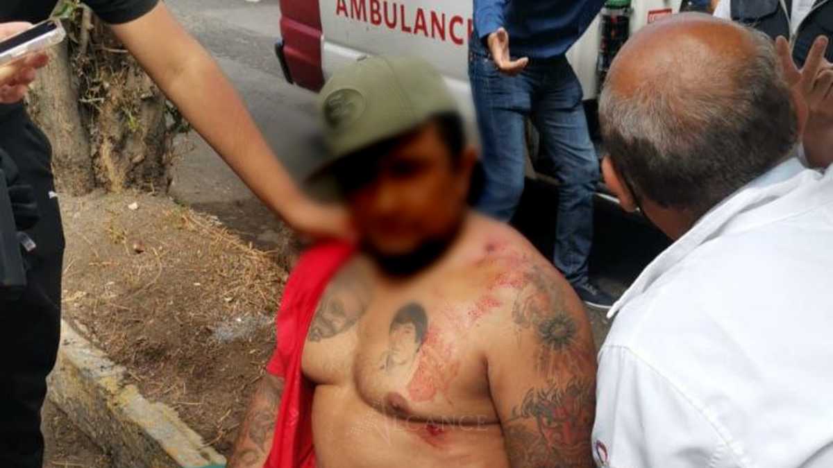 Sujeto baleado