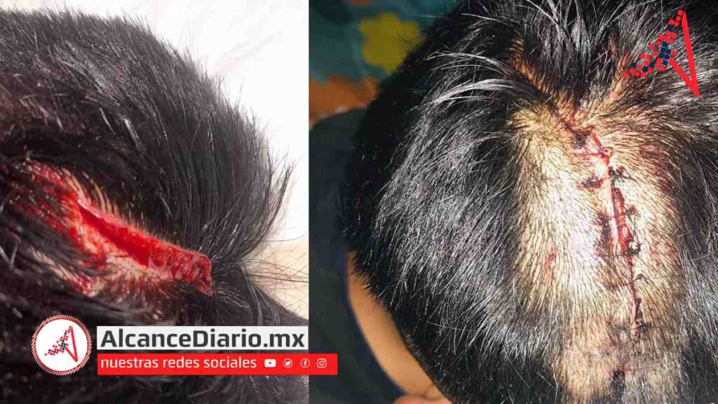 lo machetean para robarle