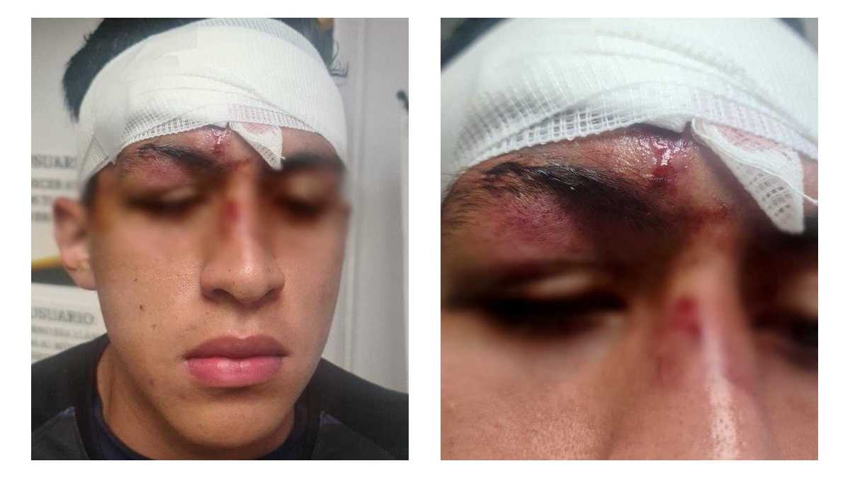 Joven golpeado por hijo de la directora de Comunicación estatal