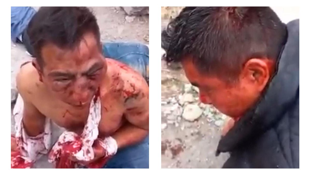 Agentes agredidos en Izúcar