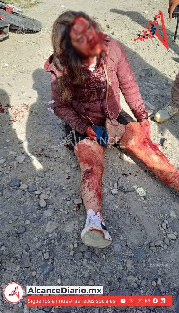 Joven se accidenta para evitar asalto en Cuapiaxtla