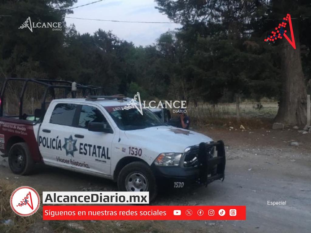 Ahora otro perro se pasea con una pierna humana en Bosques de Santa Anita