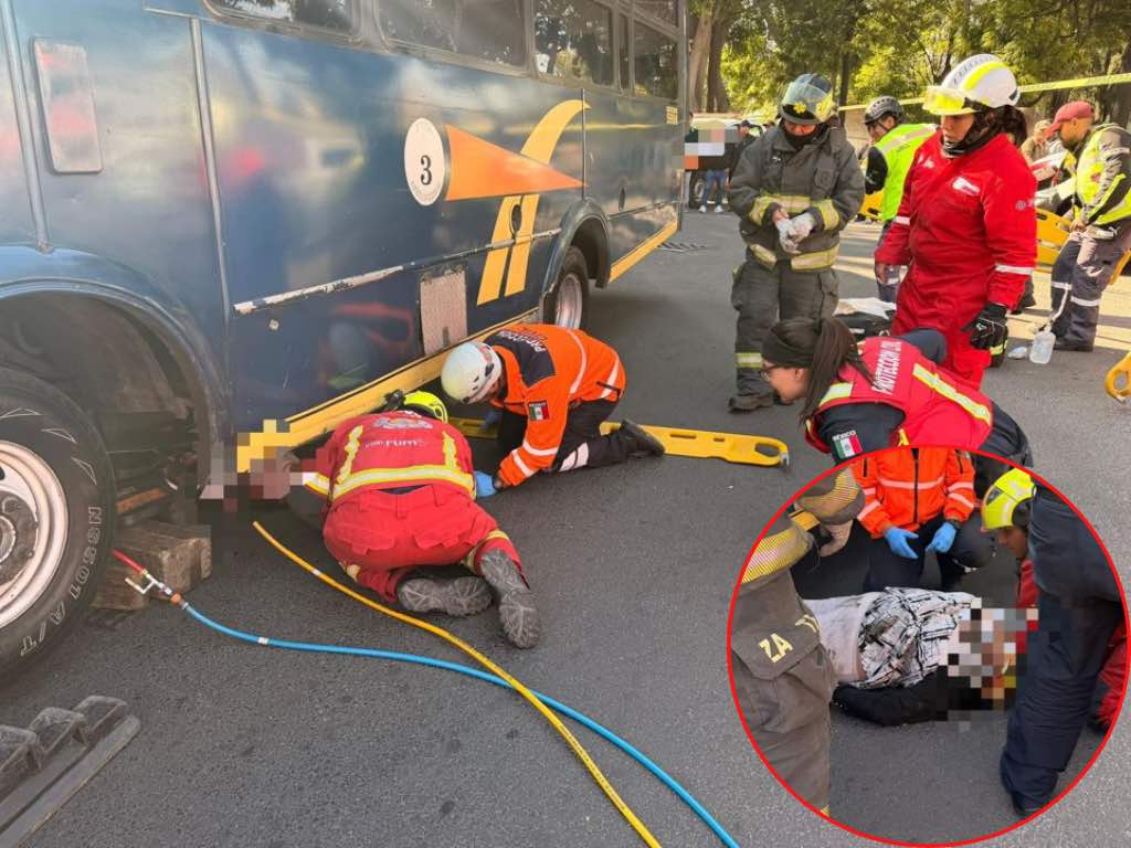 ¡Sobrevive de milagro! Ruta 3 atropella a mujer de la tercera edad, quedó atrapada debajo de la unidad