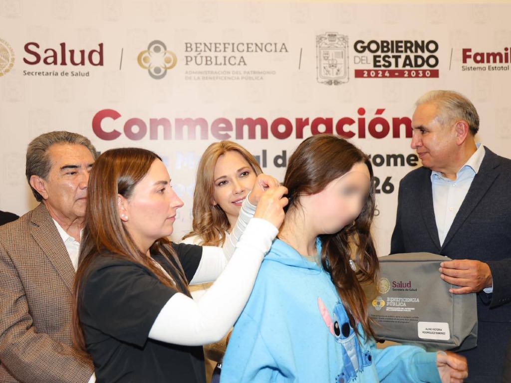 SEDIF Puebla y Beneficencia Pública transforman vidas de menores con Síndrome de Treacher Collins