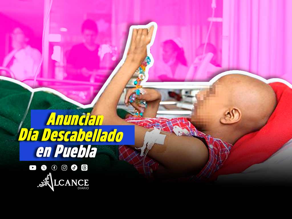Puebla ocupa cuarto lugar en cáncer infantil; anuncian “Día Descabellado” en apoyo a pacientes